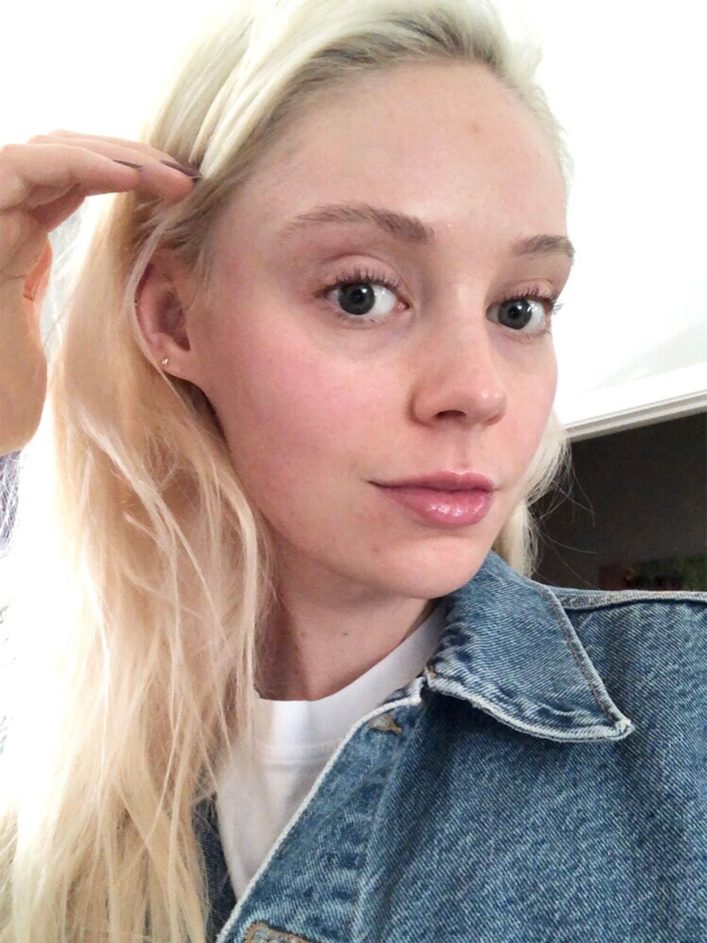 Everything You Need to Know About Vitamin B5 for Acne Who What Wear