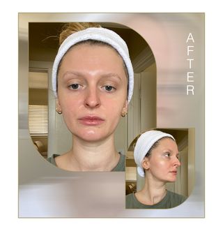 nuface-toning-device-review-297126-1641518143120-main