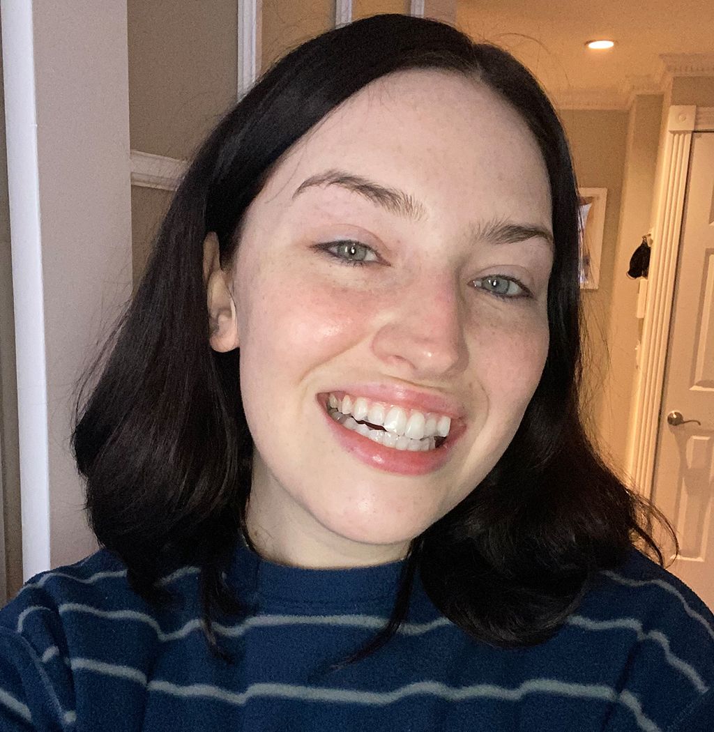 Reviewed Dissolving Whitening Strips Who What Wear