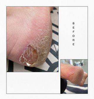 barefoot-scientist-reboot-ultra-soft-exfoliating-foot-peel-301228-1658359006375-main