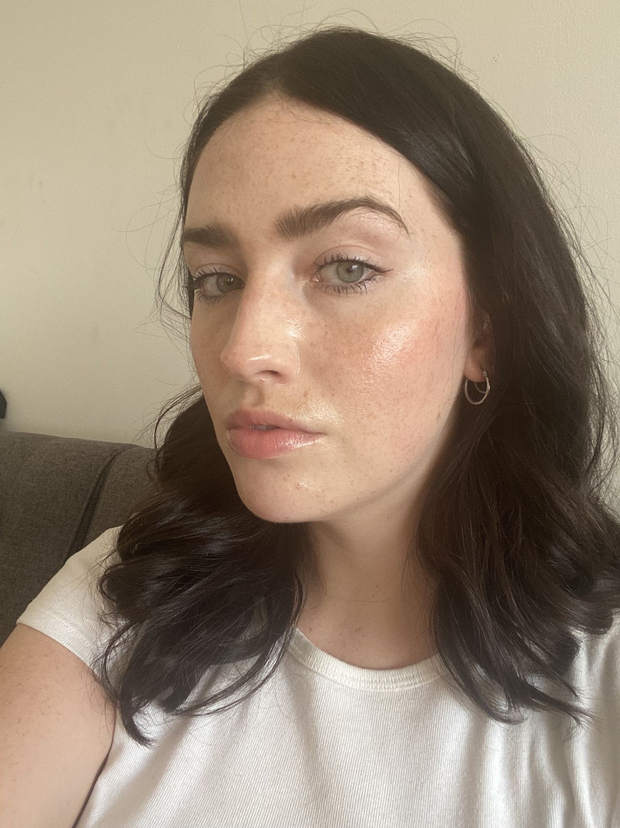 Hyaluronic Acid Fillers Benefits, Drawbacks, Cost and More Who What Wear