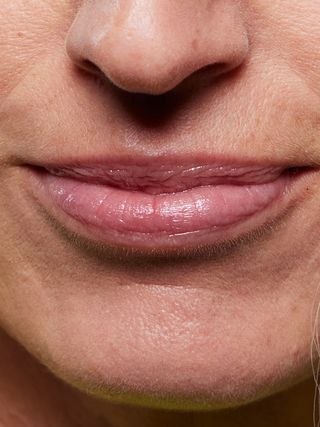 how-to-get-rid-of-lip-lines-302882-1665063594041-image