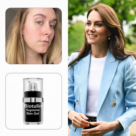 kate-middleton-serum-307264-1684363261434-square