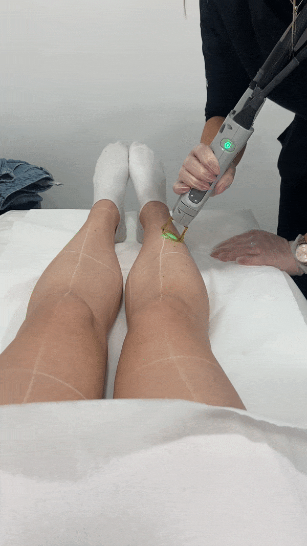 laser-hair-removal-review-307771-1686675819500-image