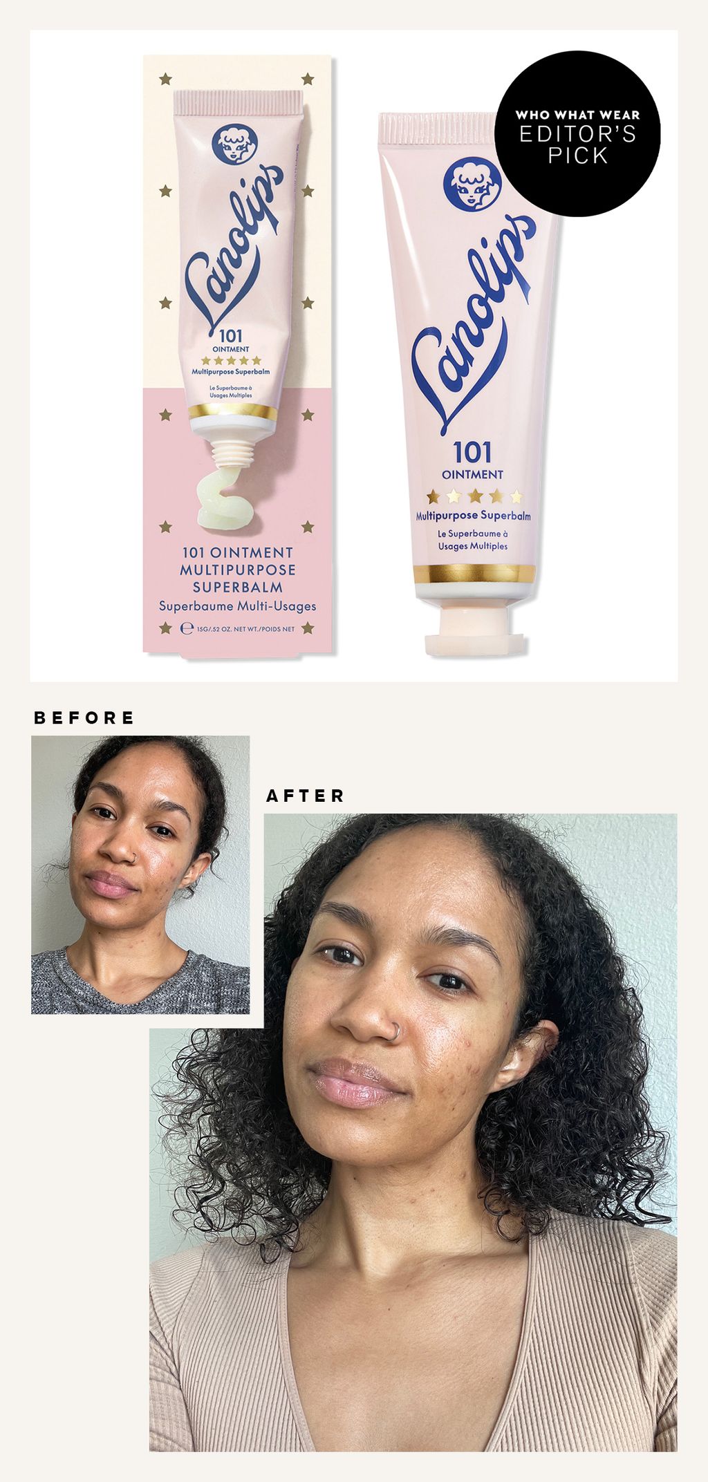 The 10 Best Lip Balms, EditorTested and Reviewed Who What Wear