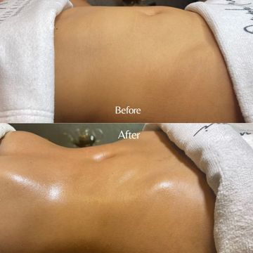 Lymphatic Drainage Massage Reviewed by a Beauty Editor | Who What Wear