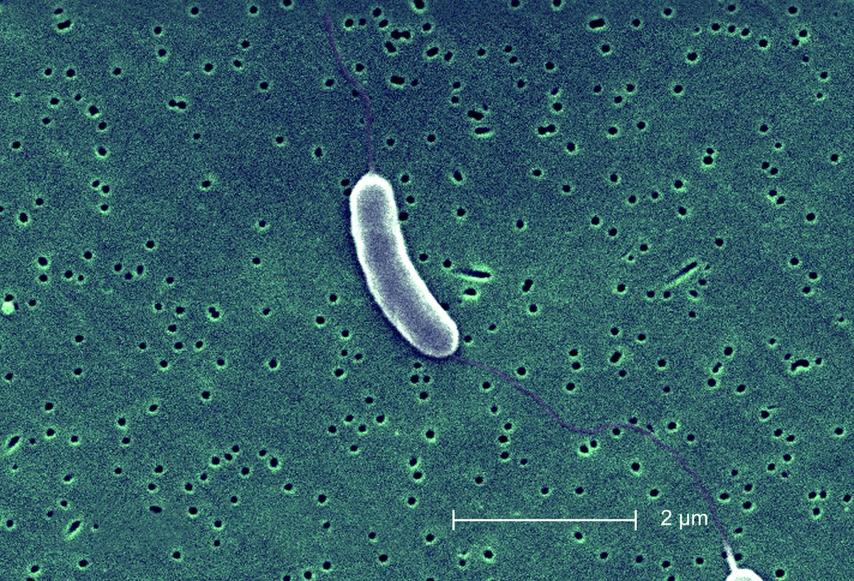 vibrio, vibrio vulnificus, v. vulnificus 