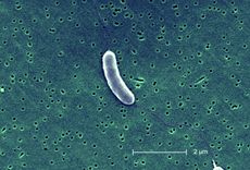 vibrio, vibrio vulnificus, v. vulnificus 