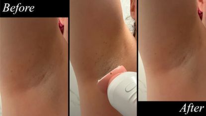 10 Best Electric Razors for Smooth Skin, Tested by Editors | Marie Claire