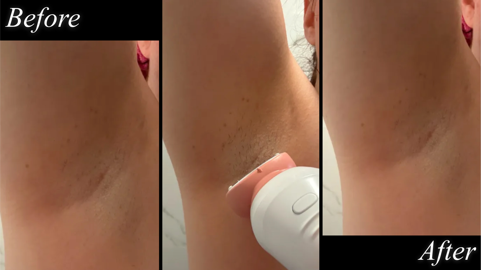 electric razors