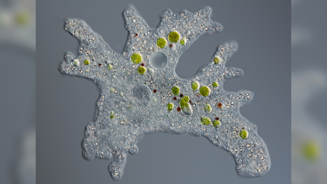 Amoeba Proteus Under Microscope