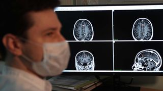 A medical staff member sits in front of a screen showing brain scans from an MRI scanner
