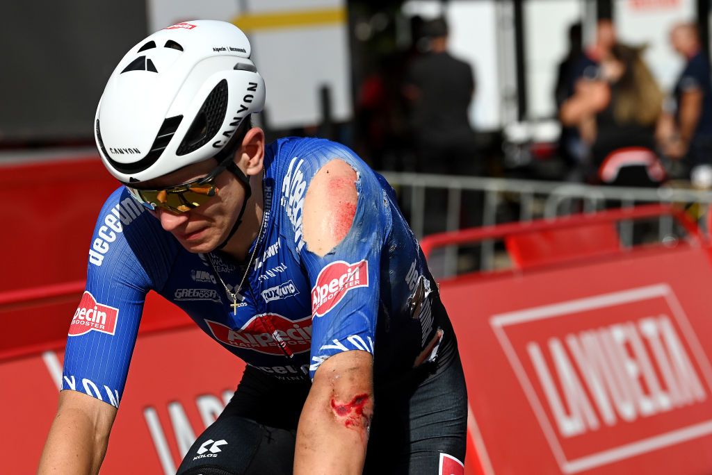 SCAR SPAIN SEPTEMBER 15 Detailed view of the injury of Tobias Bayer of Austria and Team AlpecinDeceuninck during the 78th Tour of Spain 2023 Stage 19 a 1771km stage from La Baeza to scar UCIWT on September 15 2023 in scar Spain Photo by Tim de WaeleGetty Images