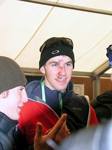 Troy Wells took a beating