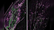 Sagittal sections of mouse clitoris (left) and mouse penis (right) stained for S100 (magenta) and tdtomato (green) showing higher density of Krause corpuscles in the clitoris. S100 is a marker for terminal Schwann cells that wrap around the nerve terminals, while tdtomato labels the sensory nerve that innervates the Krause corpuscles.