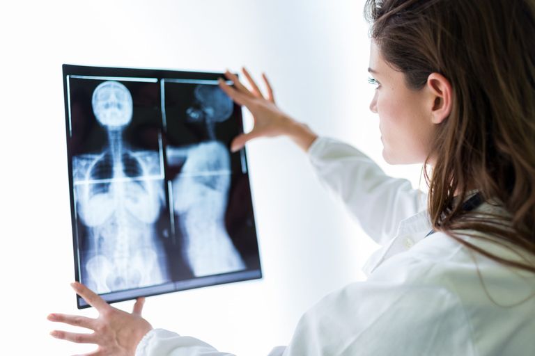breast cancer symptoms