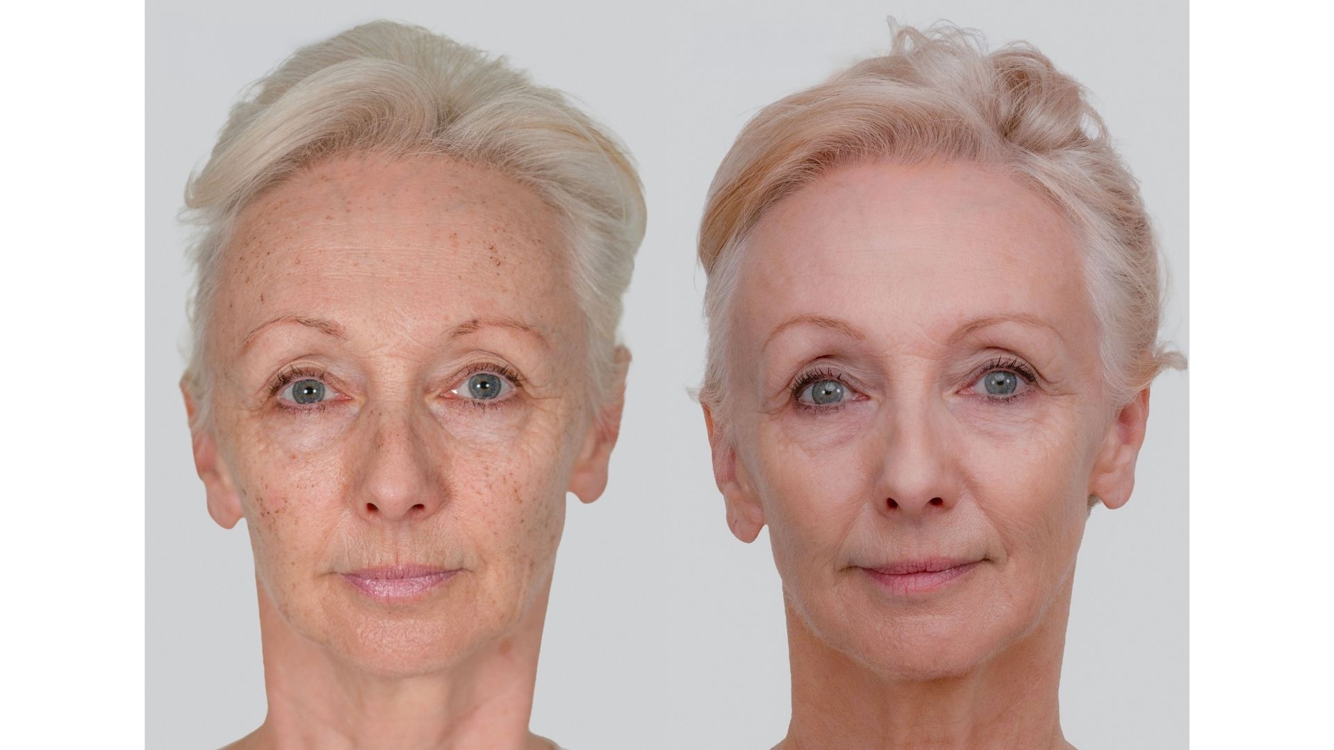 Debbie McGee Neogen before and after