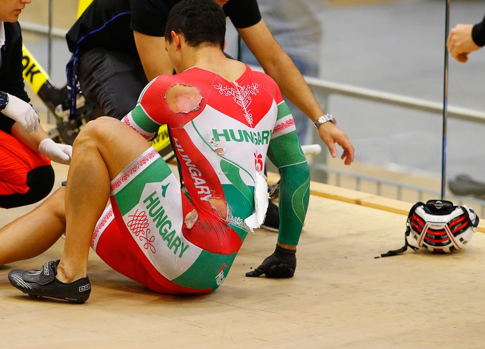 A crash in the keirin caught many out