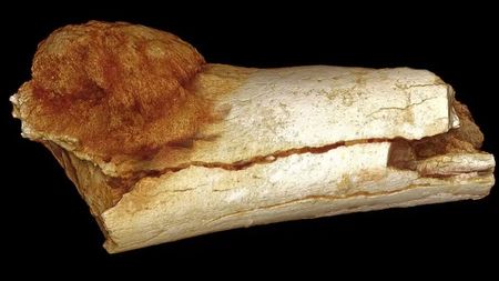 A prehistoric toe bone that contains cancer. 