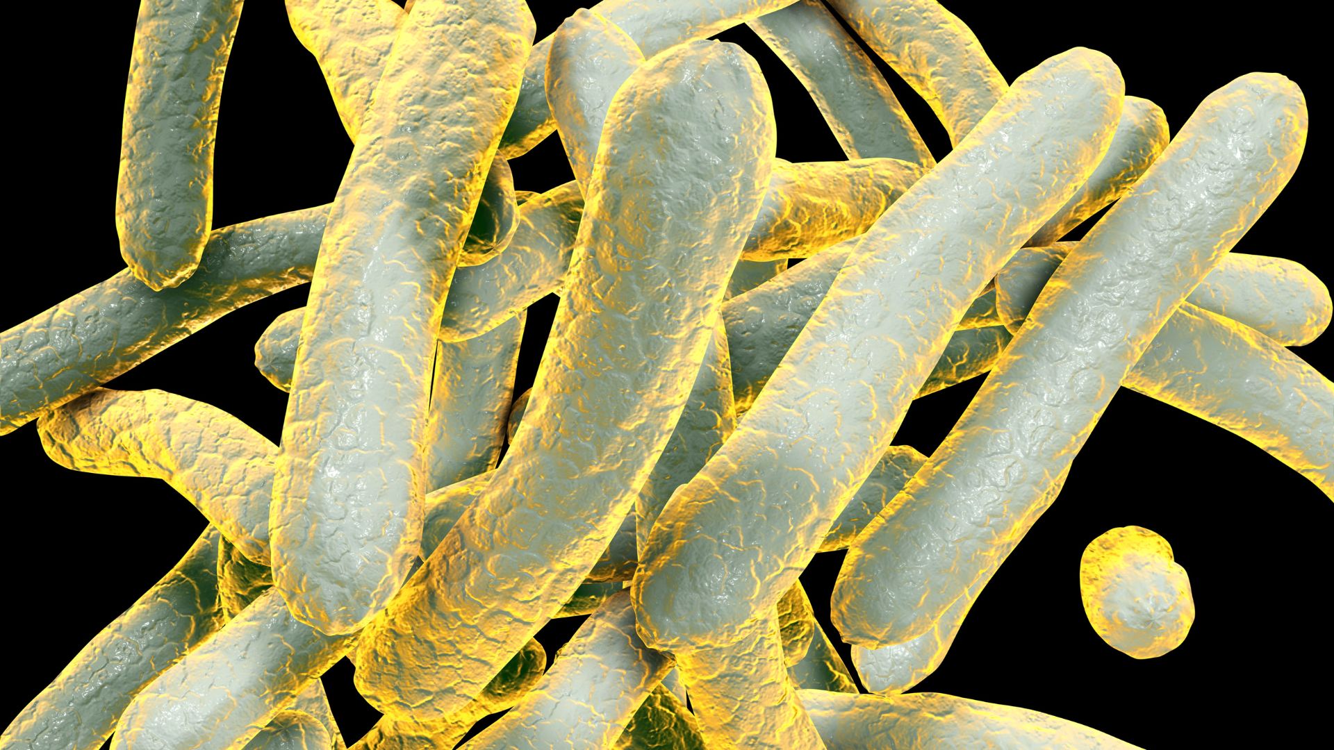 170 people 'likely exposed' to tuberculosis in Long Beach outbreak