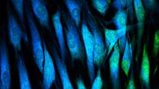 Stock photo of fibroblasts (skin cells) labeled with fluorescent dyes.