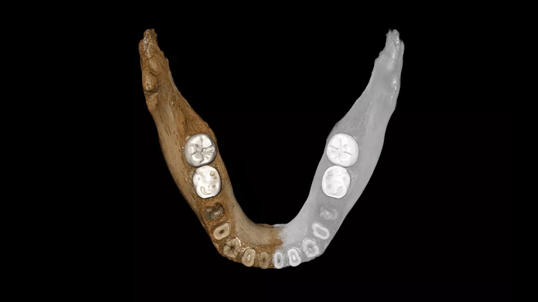 A virtual reconstruction of the Xiahe mandible after digital removal of the adhering carbonate crust. Mirrored parts are in gray.