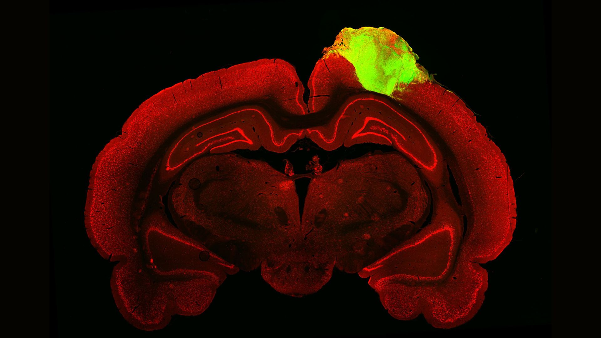 histological image exhibits a dreadful fragment of a rat's brain, depicted in crimson, with a beautiful green blob on the tip honest aspect; the blob is a clump of cells called an organoid that is been derived from human stem cells and transplanted into the rat's brain