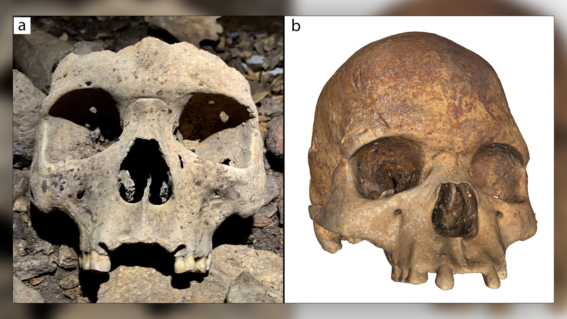 A skull (a) and photogrammetry of a skull (b) showing how the individuals had their upper incisors removed. 