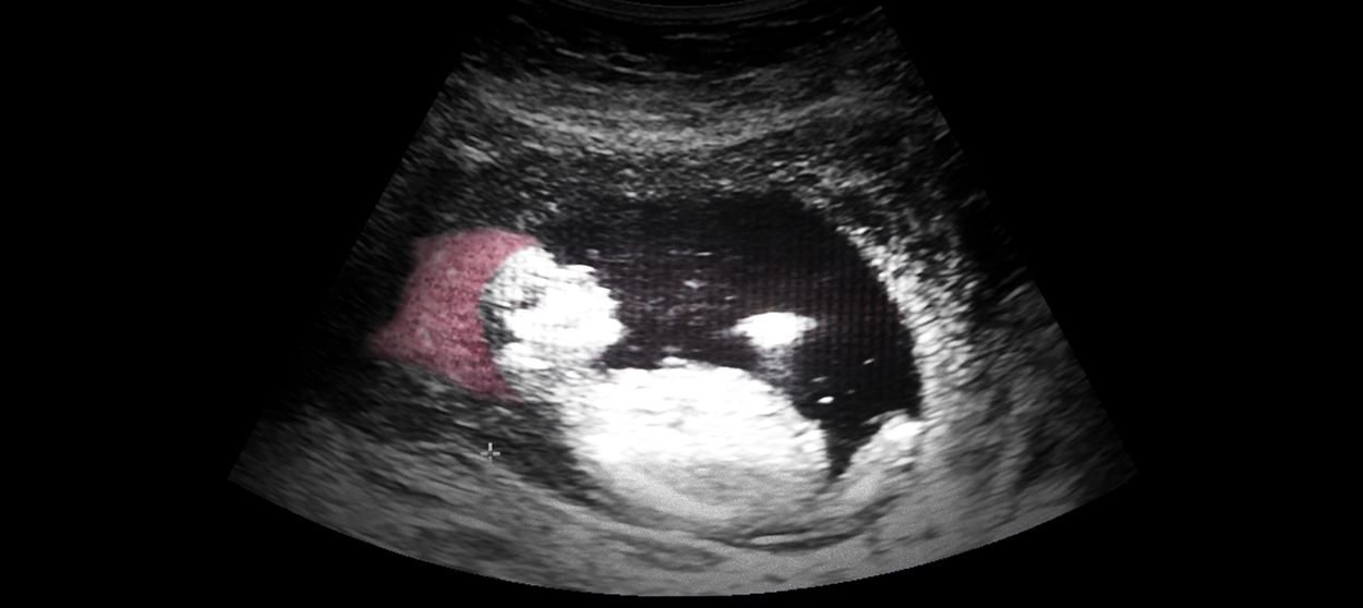 A sonogram.