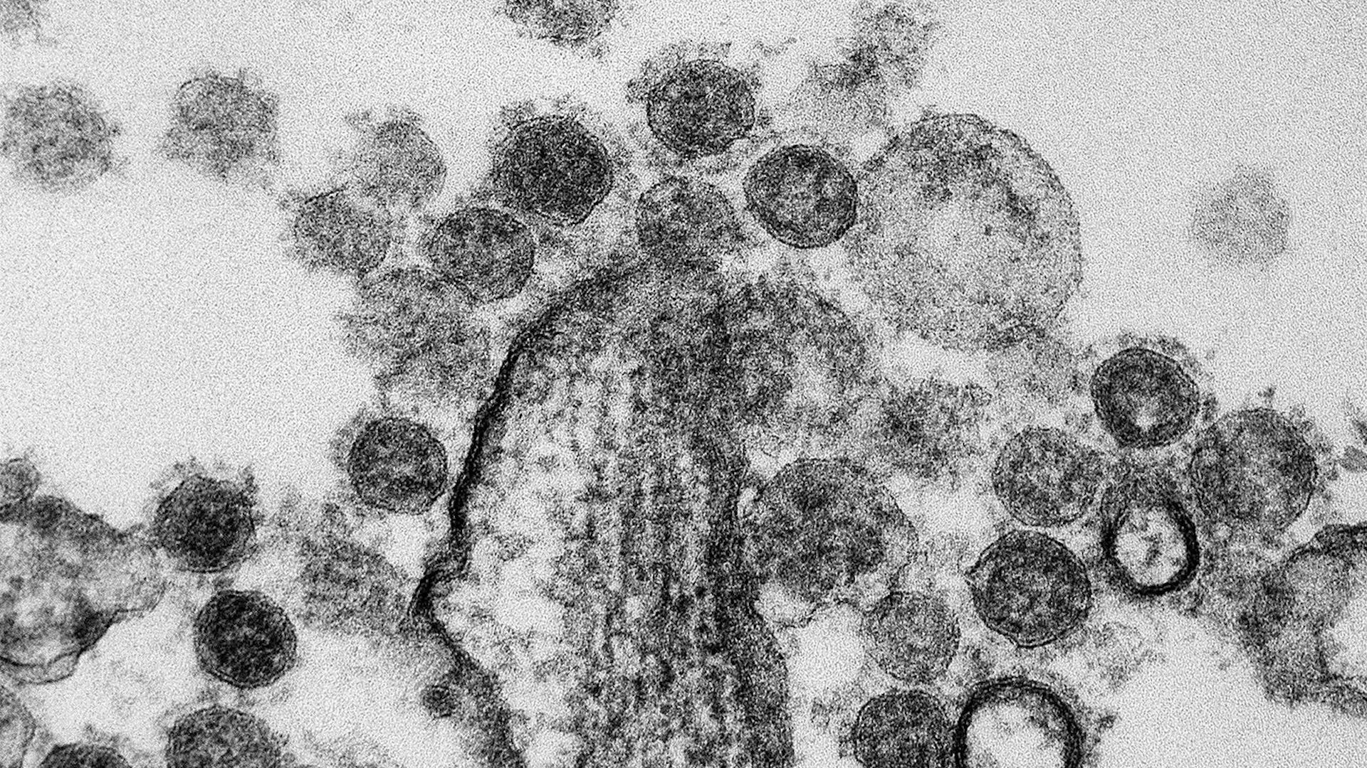 A black and white micrograph of coronavirus particles