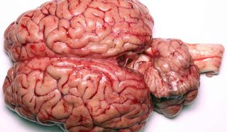 brain-human-111101-02