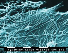 Ebola Virus Image