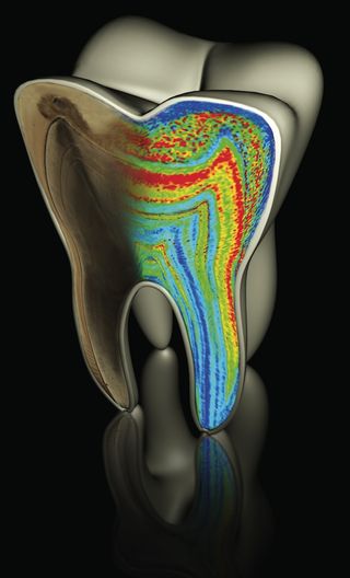 Barium growth in teeth