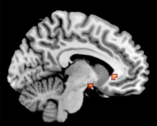 Brain regions associated with guilt and depression.