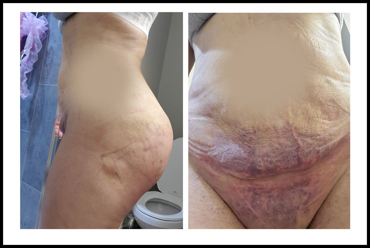 Photos from Goals patients