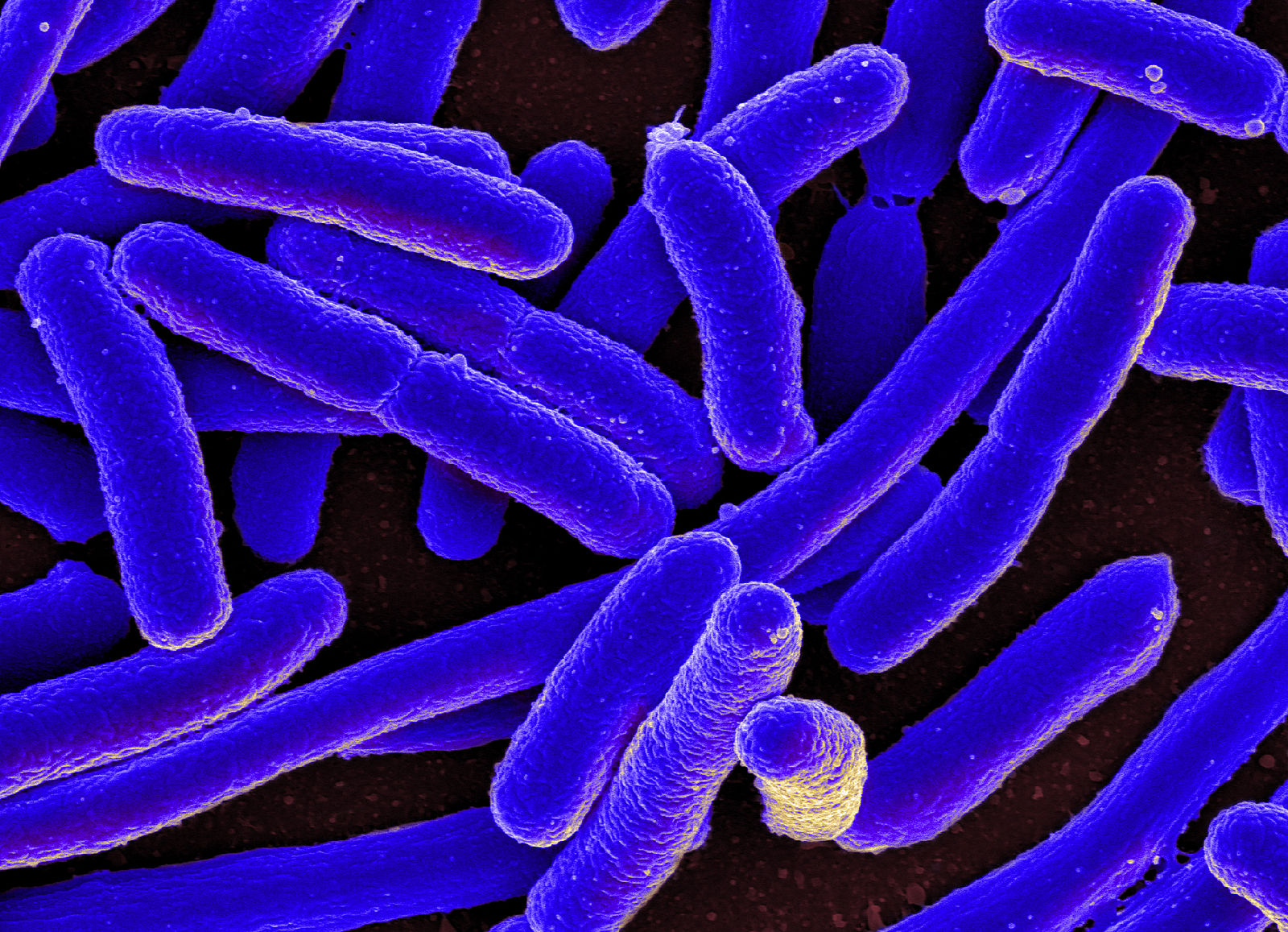 E. coli