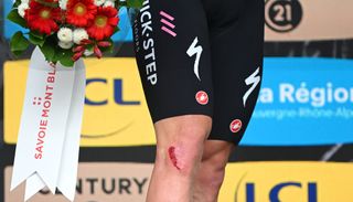 BOISSETSAINTPRIEST FRANCE JUNE 06 Legs injury detailed view of Remco Evenepoel of Belgium and Team Soudal QuickStep celebrates at podium as White best young jersey winner during the 76th Criterium du Dauphine 2024 Stage 5 a 167km stage from Amplepuis to SaintPriest Race neutralised due to a multiple riders crash and dropouts UCIWT on June 06 2024 in BoissetSaintPriest France Photo by Dario BelingheriGetty Images