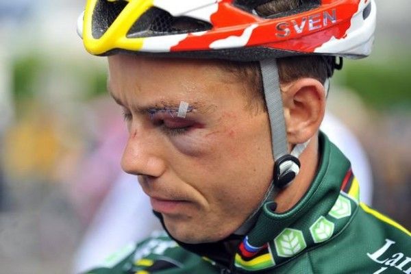 Sven Nys and his black eye