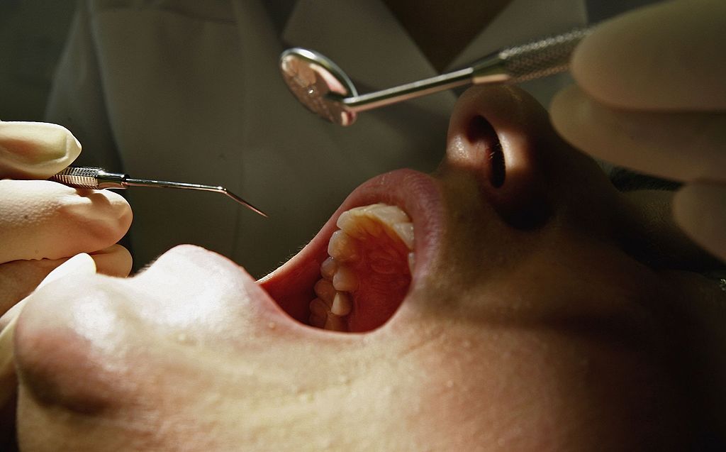 Dentist examining teeth