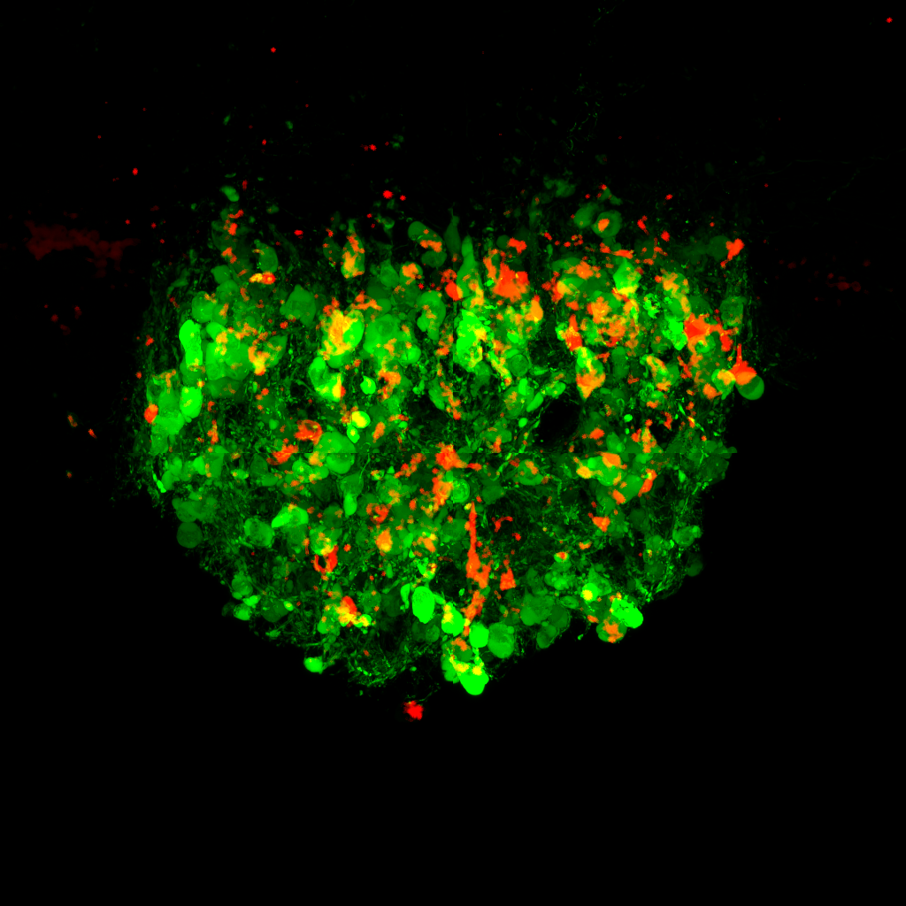 &quot;Thirst neurons&quot; light up in the subfornical organ of the brain.