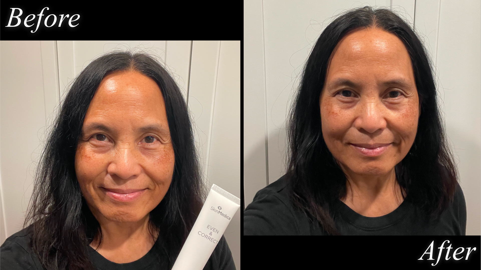 Ann Malzahn before and after testing SkinMedica Even & Correct Dark Spot Cream