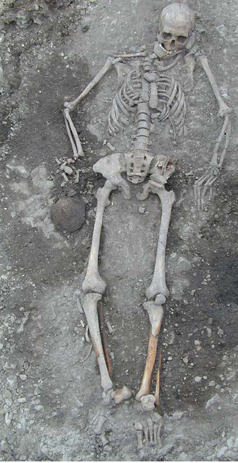 skeleton excavated from a grave in Sweden