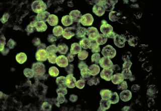 Naegleria fowleri, also known as the "brain-eating" amoeba