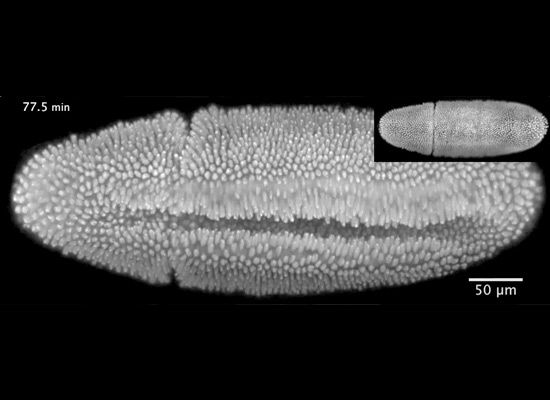 A fruit-fly embryo at just over an hour old.