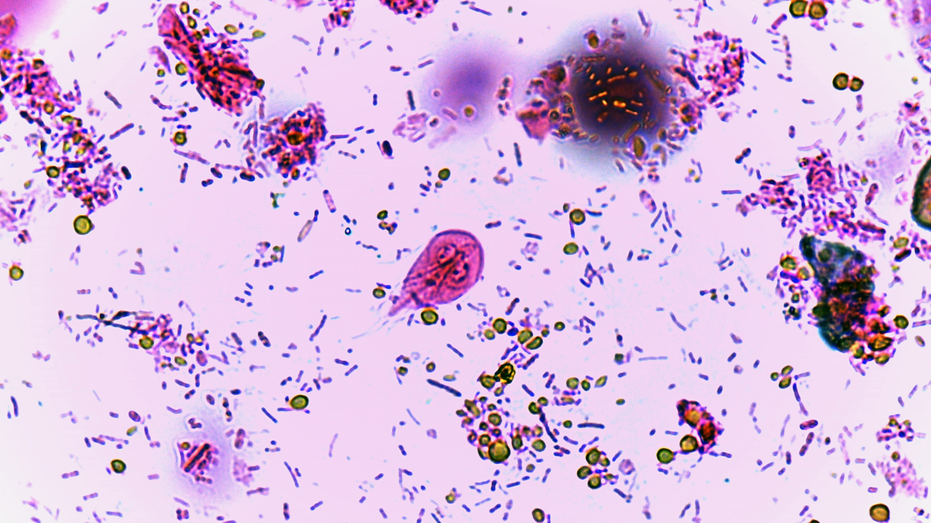 A photo of the giardia lamblia parasite under a microscope.