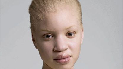 beautiful albino people