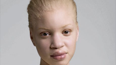 Centimeter Villain Picasso albino black person - Kenosha Robinson - people with albinism | Marie Claire