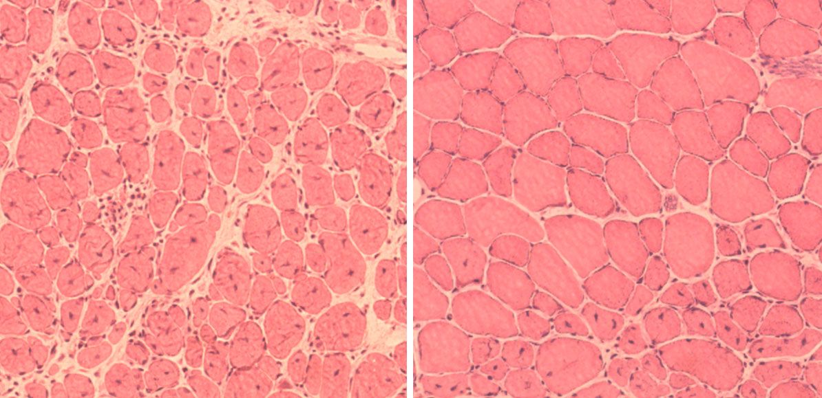 On the left, muscle cells from old mice that have an impaired ability to repair themselves. On the right, muscle cells from old mice after treatment with &quot;reprogramming factors,&quot; which improved muscle regeneration.