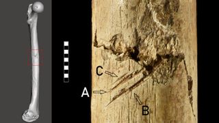 an image of a femur with a zoomed-in inset showing projectile impact marks
