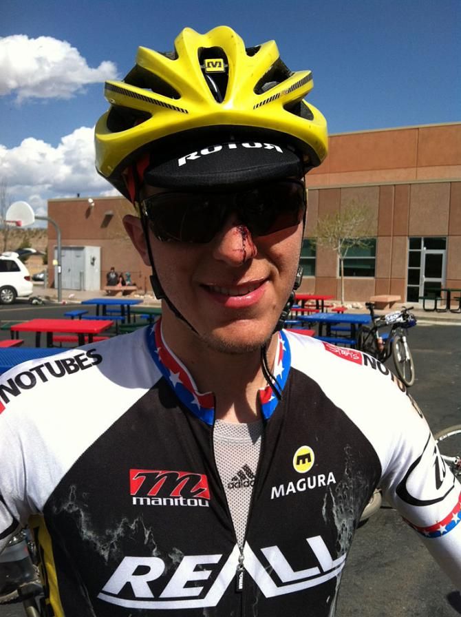 Evan Plews managed to finish fourth despite a crash. Here is is after the finish.